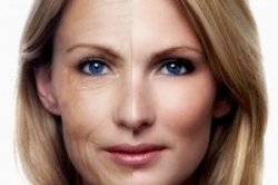 Aging Skin Problems