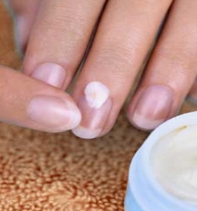 Causes Of Peeling Nails
